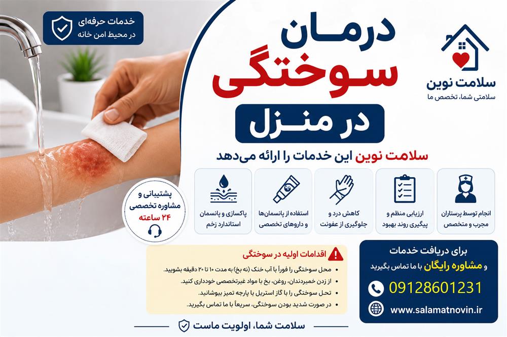 درمان سوختگی در منزل